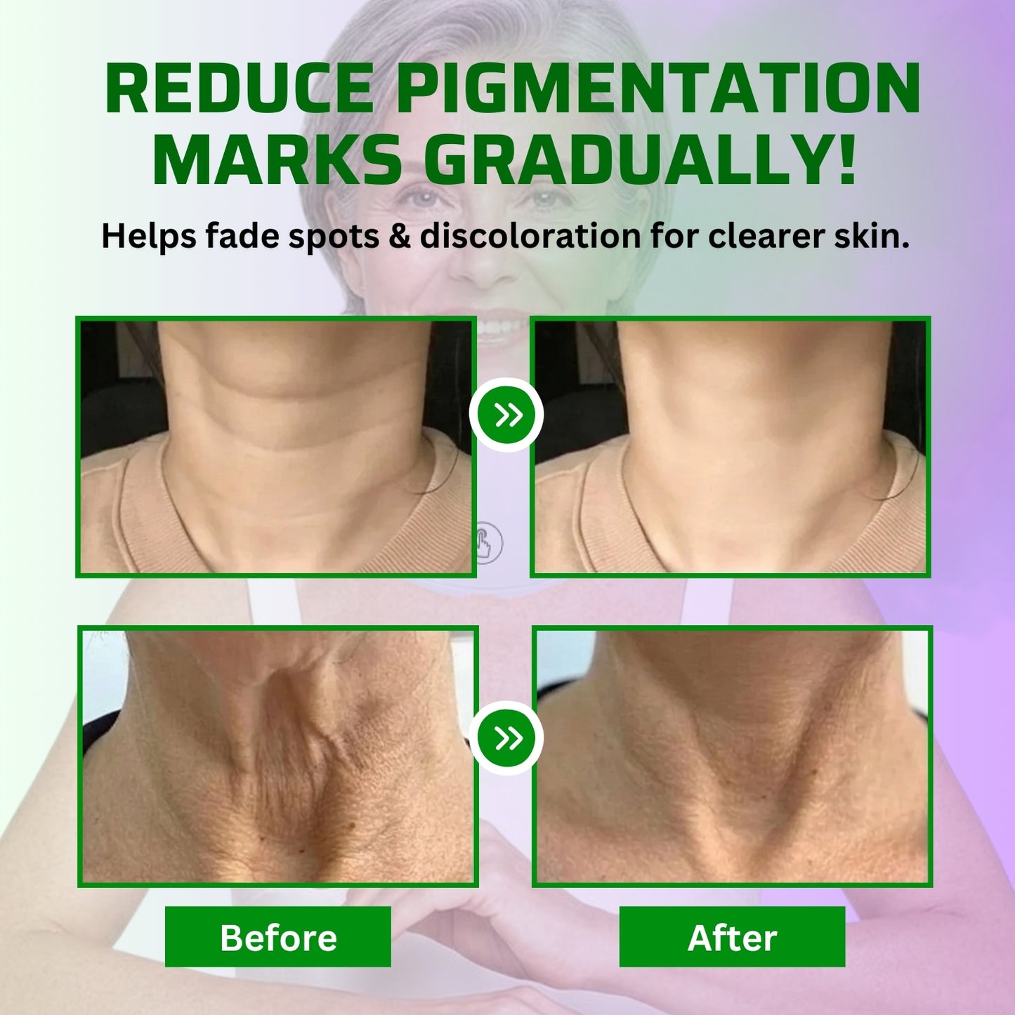 NeoLux Neck System™